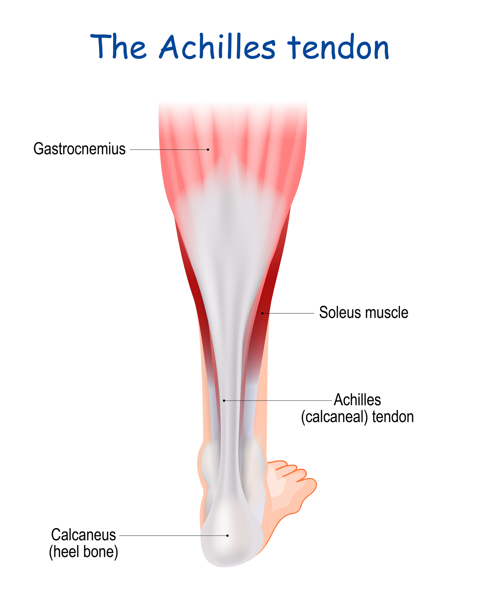 What you need to know about tight calves