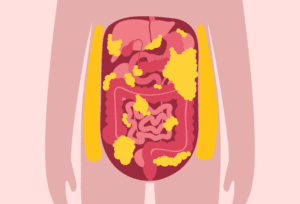 Anatomy of a slim body showing organs covered with visceral fat.
