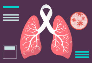 Visual of the lungs highlighting cancer development with a close-up of abnormal cells.