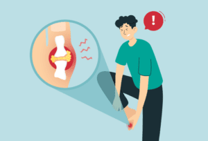 Man experiencing a gout flare-up affecting his big toe.