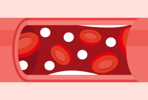 Excessive calcium linked to hypercalcemia risk