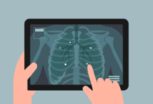 CT scan image showing white spots of varying sizes.