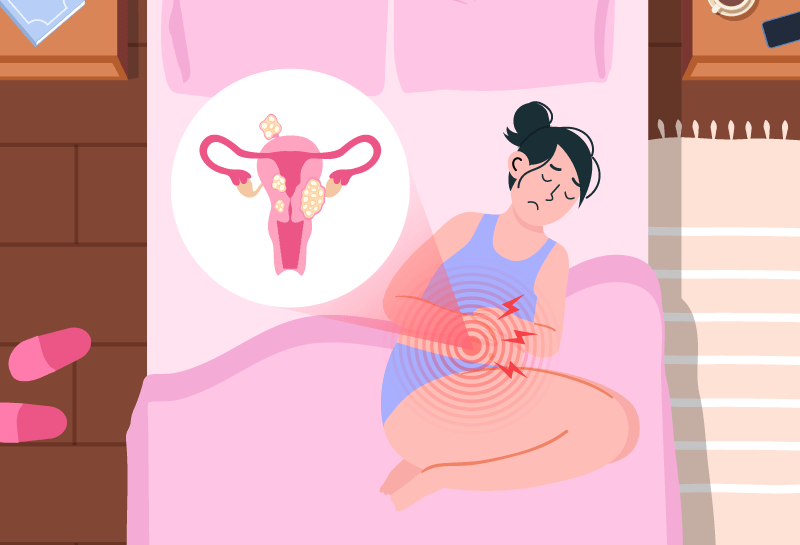 Woman experiencing uterine fibroids, which may indicate a more serious underlying health condition.