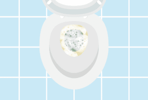 Foamy urine that may signal underlying kidney problems