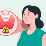 Nutrition insights to managing Hashimoto's disease
