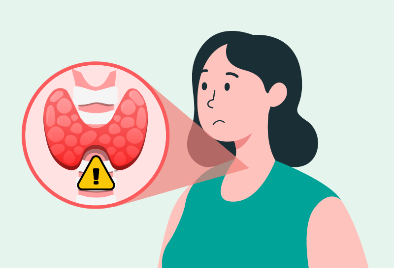Nutrition insights to managing Hashimoto's disease