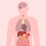 Diagram of upper body anatomy highlighting areas of mild organ infection.