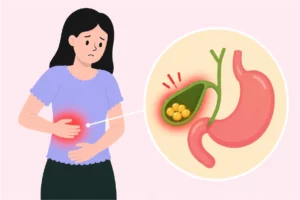 Women experiencing pain due to gallstones
