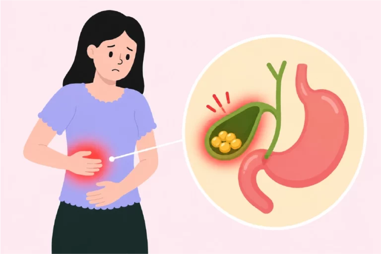 Women experiencing pain due to gallstones